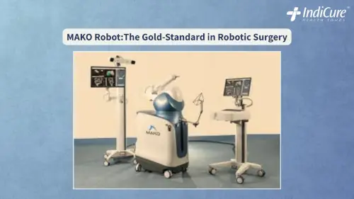 MAKO Robot system for orthopedic surgery, illustrating the advanced robotic arm and accompanying screens used for MAKO Robotic Surgery in India.